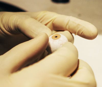 Can 3D Printers Really Make Prosthetic Eyes?