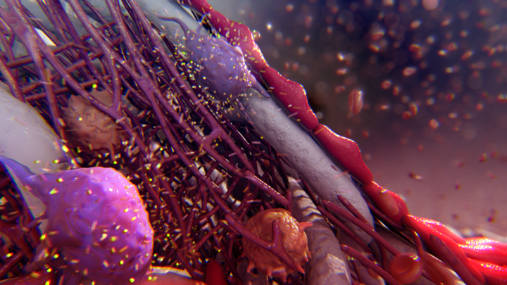 Aditlys could improve the lives of Hemodialysis patients with first tissue-growing implant